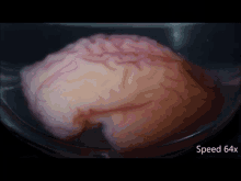 Smooth Brain Dewrinkle GIF - Smooth Brain Dewrinkle Anatomy GIFs