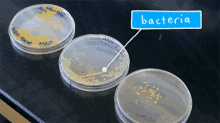 Bacteria Petridish GIF - Bacteria Petridish Cell Culture GIFs