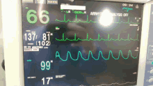 Electro Cardiologia GIF - Electro Cardiologia Medicina GIFs