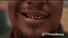 tvresidence dirty money gold teeth documentary series