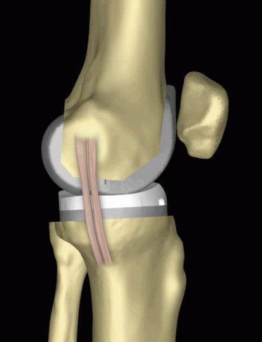 Knee Articulate Joint GIF - Knee Articulate Joint Bones GIFs