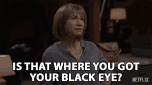 Where Black Eye GIF - Where Black Eye Joanne GIFs