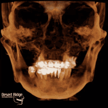 Desert Ridge Oral Surgery GIF - Desert Ridge Oral Surgery GIFs