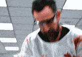 a man wearing a surgical gown and safety glasses has blood on his shirt