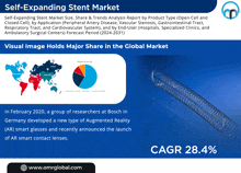 Self-expanding Stent Market GIF - Self-expanding Stent Market GIFs