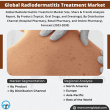 Radiodermatitis Treatment Market GIF - Radiodermatitis Treatment Market GIFs