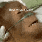 a picture of a monkey with an oxygen mask and the words boys what is daily below it