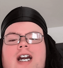 a man with glasses and braces on his teeth is wearing a black headband