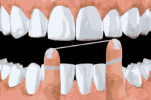 Flossing Teeth GIF - Flossing Teeth Mouth GIFs