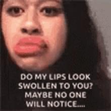 lips swollen face maybe no one will notice