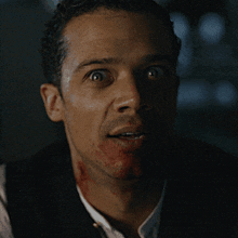 a close up of a man 's face with blood on it