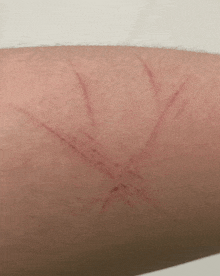 a close up of a person 's arm with a few scratches on it