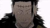 a close up of a person 's face with a stitch in his forehead