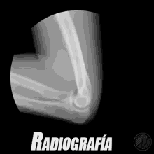Radiografía Decodo GIF - Radiografia Rayos X Huesos Del Codo GIFs