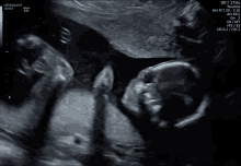 Womb Baby GIF - Womb Baby Fabrizio Federico GIFs