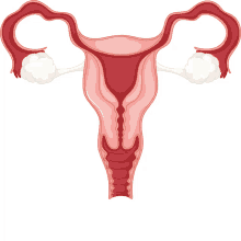 endometriose endometriosis
