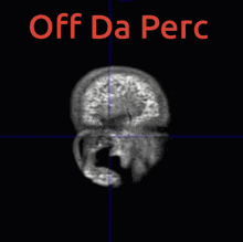 Off Da Perc Off The Perc GIF