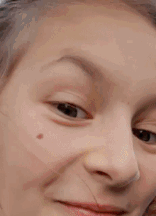 a close up of a girl 's face with a spot on her cheek .