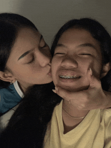 a girl with braces on her teeth is kissed on the cheek by another girl