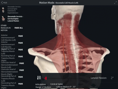 Iliocostalis Colli Lateral Flexion GIF - Iliocostalis Colli Lateral Flexion Cervical Spine Lateral Flexion GIFs
