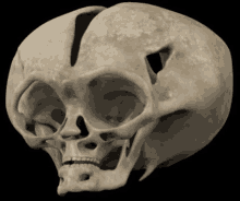 Skull Emoji GIF - Skull Emoji GIFs