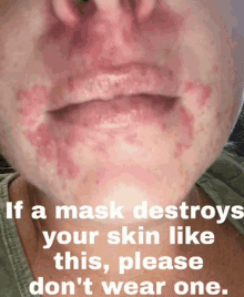 If A Mask Destroys Your Skin Like This GIF - If A Mask Destroys Your Skin Like This Please Dont Wear One GIFs