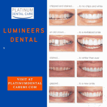lumineers dental
