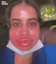 a woman with a mask on her face has a huge lip .