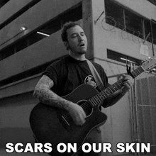 Scars On Our Skin Tyler Zanon GIF - Scars On Our Skin Tyler Zanon Youth Fountain GIFs