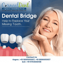 an advertisement for dental bridges shows a woman with her hand on her chin