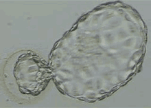 Hatching Blastocyst GIF - Hatching Blastocyst GIFs
