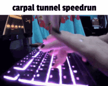 Carpal Tunnel GIF - Carpal Tunnel GIFs