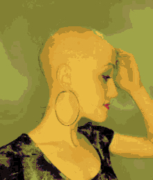 woman bald