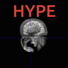 Hype Hype 1 GIF - Hype Hype 1 Hype 2 GIFs