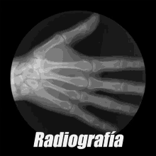 Radiografía De Mano GIF - Radiografia Rayo X Huesos De La Mano GIFs