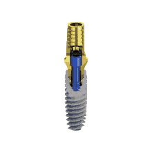 Biotec Implant B1conical Connection GIF