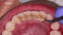 Dentrie GIF - Dentrie GIFs