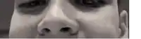 a close up of a man 's face with a black eye and a white background .