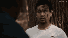Bloodied Wounded GIF - Bloodied Wounded Rapid Eye Movements GIFs