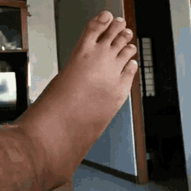 Swollen Feet GIFs | Tenor