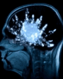 Beyin Mazgi GIF