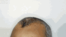 a close up of a man 's head with a bald spot on it against a white background .