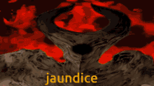 Jaundice GIF - Jaundice GIFs