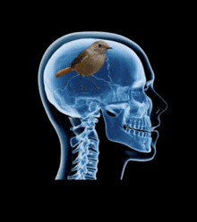 an x-ray of a person 's head with a bird on top