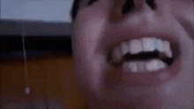 a close up of a person 's mouth and teeth with a purple background