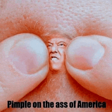 Trump Ass Pimple GIF - Trump Ass Pimple GIFs