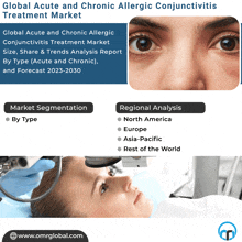 Acute And Chronic Allergic Conjunctivitis Treatment Market GIF - Acute And Chronic Allergic Conjunctivitis Treatment Market GIFs