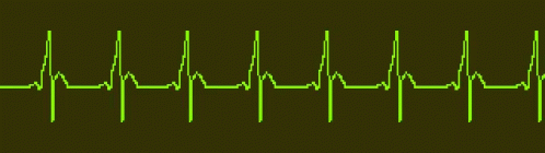 Ekg Heart Rate GIF - Ekg Heart Rate GIFs
