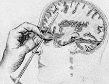 a black and white drawing of a person holding a syringe in front of their brain .