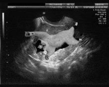 a black and white ultrasound image of a cat in a woman 's uterus